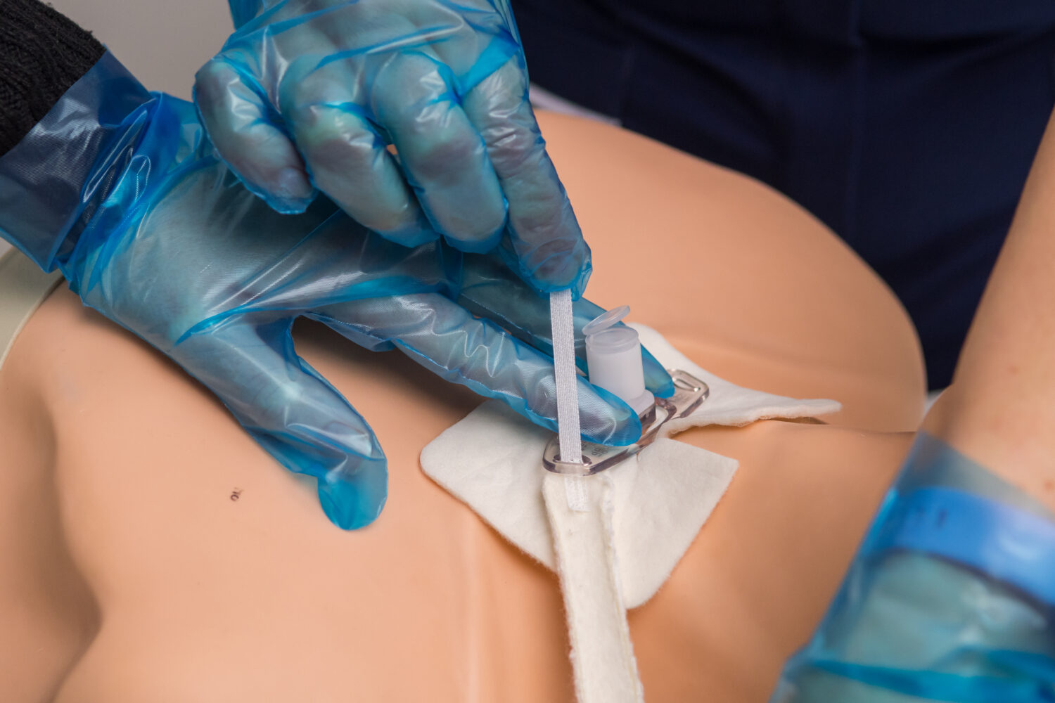 Tracheostomy care
