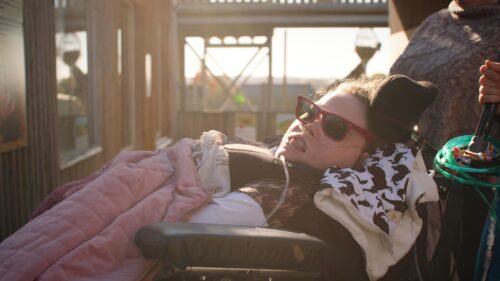 Hypoxic Ischaemic Encephalopathy (HIE)